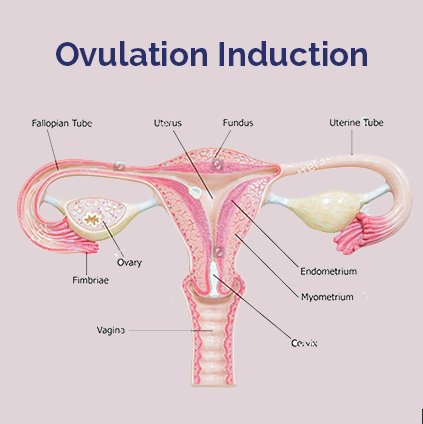 Ovulation Induction